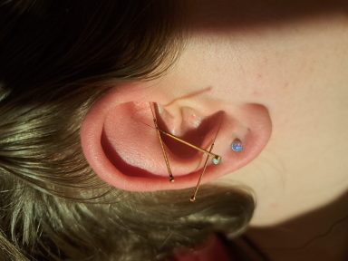 Akupunktur Ohr Akupunktur